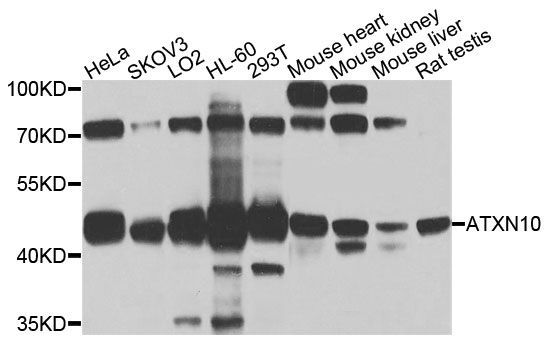 Western blot - ATXN10 antibody (144-04586)