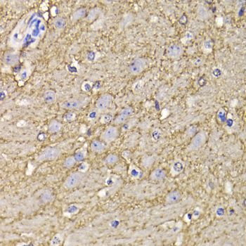 Immunohistochemistry - KCND3 antibody (144-06927)