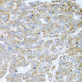 Immunohistochemistry - NDUFA2 antibody (144-08136)