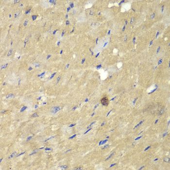 Immunohistochemistry - AKR7A2 antibody (144-01227)