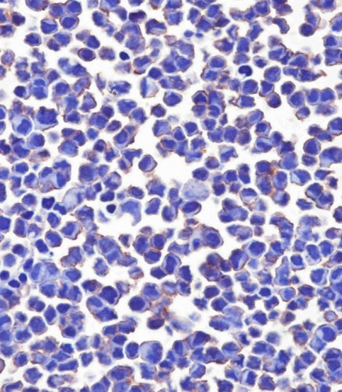 IHC-P