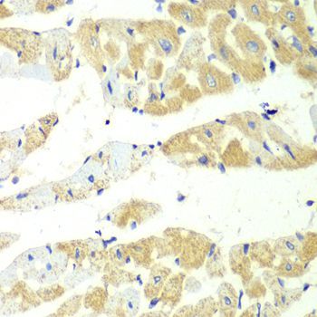 Immunohistochemistry - TBXAS1 antibody (144-60304)