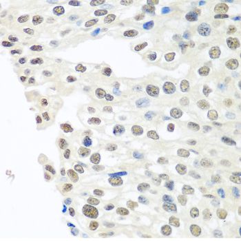 Immunohistochemistry - TARDBP antibody (144-013405)