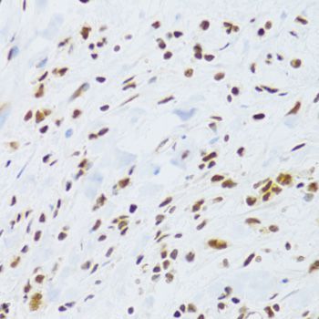 Immunohistochemistry - DDB1 Polyclonal Antibody (144-02896)