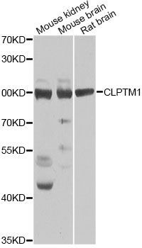 Western blot - CLPTM1 Antibody (144-07656)