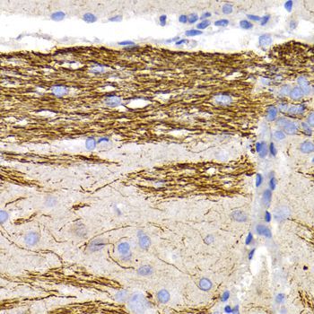 Immunohistochemistry - NEFL Polyclonal Antibody (144-00257)