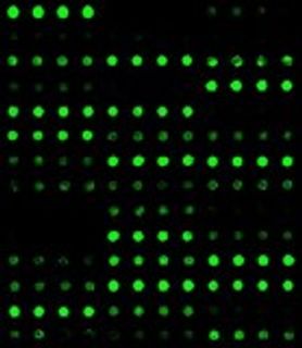 False-colored image of an antibody array after analysis.