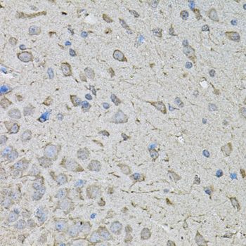 Immunohistochemistry - CDK10 antibody (144-02690)