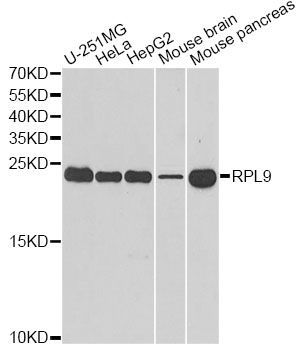 Western blot - RPL9 Polyclonal Antibody (144-06406)