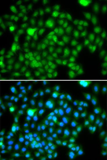 Immunofluorescence - N6AMT1 antibody (144-07201)