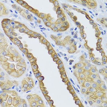 Immunohistochemistry - KRT5 Antibody (144-02662)