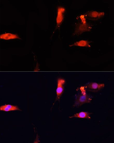Immunofluorescence - NRF1 Polyclonal Antibody (144-05547)