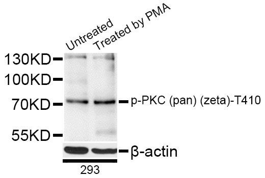 Western blot - Phospho-PKC (pan) (zeta)-T410 antibody (144-50520)