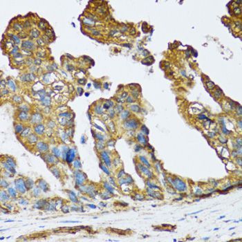 Immunohistochemistry - SLC25A13 Polyclonal Antibody (144-012557)