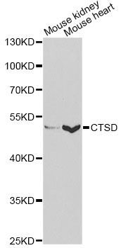 Western blot - CTSD antibody (144-60266)