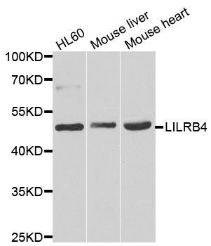 Western blot - LILRB4 antibody (144-07073)