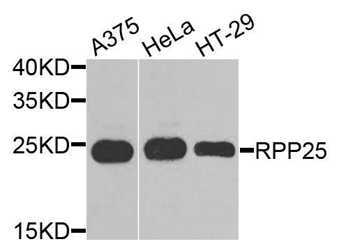 Western blot - RPP25 antibody (144-09973)