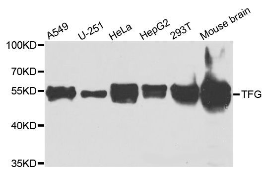 Western blot - TFG Polyclonal Antibody (144-07769)