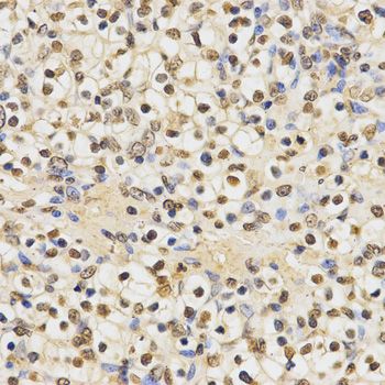 Immunohistochemistry - MonoMethyl-Histone H3-K27 antibody (144-02361)