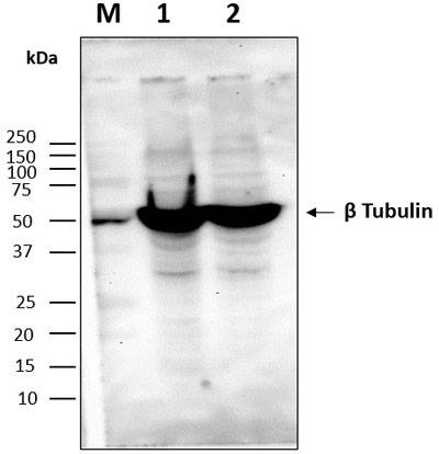 Western blot image