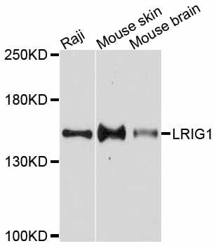 Western blot - LRIG1 Polyclonal Antibody (144-10297)