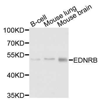 Western blot - EDNRB antibody (144-02908)