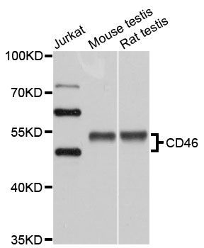 Western blot - CD46 antibody (144-01653)