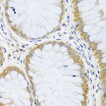 Immunohistochemistry - ARL6 antibody (144-08269)
