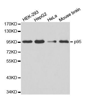 Western blot - [KO Validated] NBN Polyclonal Antibody (144-60031)