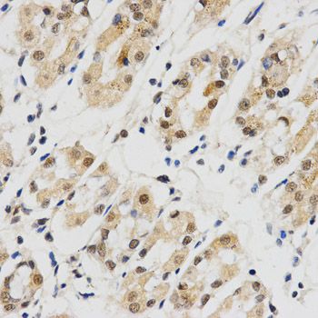Immunohistochemistry - SNRPE Antibody (144-05488)
