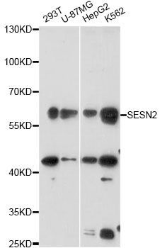 Western blot - SESN2 antibody (144-60610)