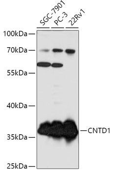 Western blot