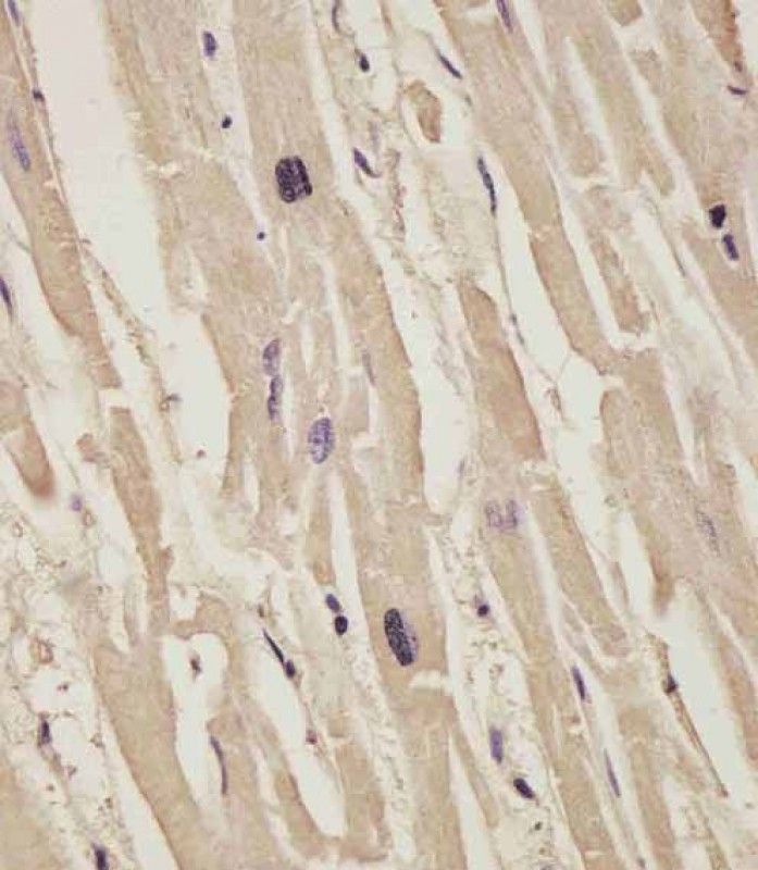 IHC-P