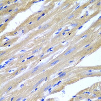 Immunohistochemistry - HSPB2 antibody (144-02350)