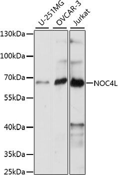 Western blot - NOC4L antibody (144-61087)