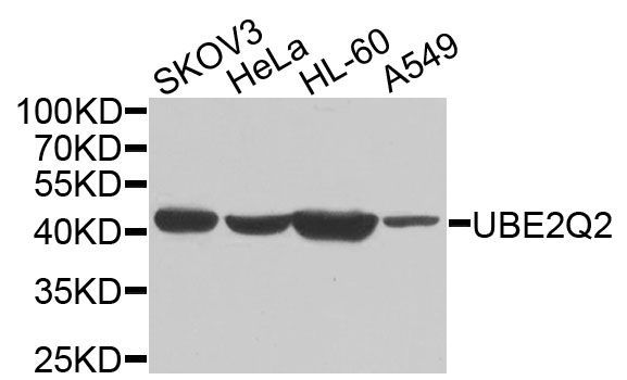 Western blot - UBE2Q2 antibody (144-09992)