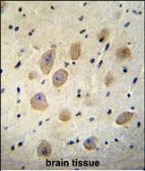 IHC-P