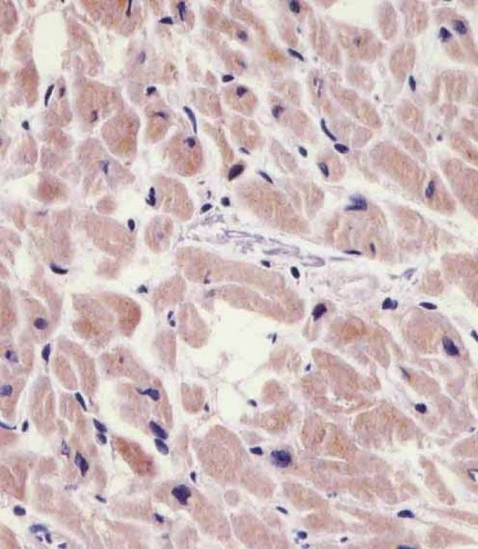 IHC-P