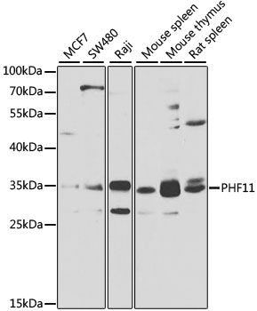 Western blot - PHF11 antibody (144-07803)