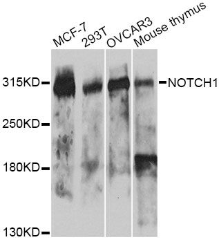 Western blot - NOTCH1 Polyclonal Antibody (144-07636)