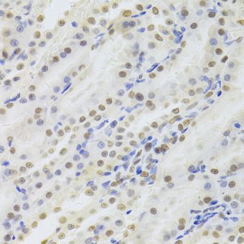 Immunohistochemistry - HDGF Antibody (144-05347)