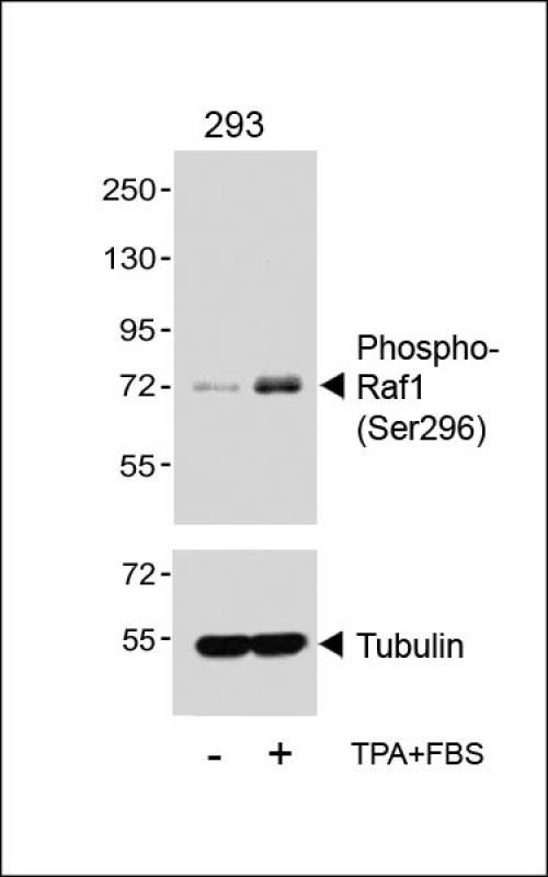 WB