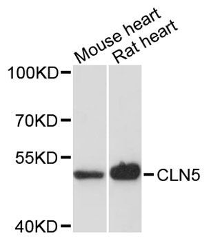 Western blot - CLN5 antibody (144-12886)
