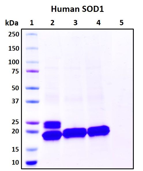 SDS-PAGE