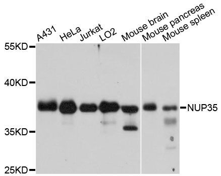 Western blot - NUP35 antibody (144-12762)