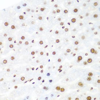 Immunohistochemistry - AGO2 antibody (144-06023)