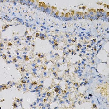 Immunohistochemistry - NPC2 Antibody (144-05413)
