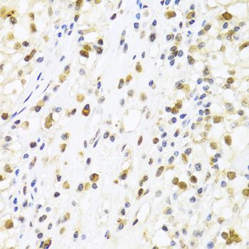 Immunohistochemistry - SUMO4 Antibody (144-03100)