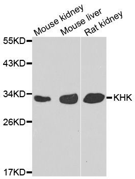 Western blot - KHK Polyclonal Antibody (144-07440)