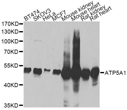 Western blot - ATP5A1 Polyclonal Antibody (144-05884)